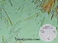 Dasyscyphella nivea-amf1397-micro